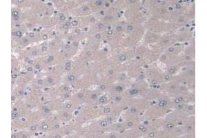 IHC-P analysis of Human Liver Tissue, with DAB staining. (IGFBP4 anticorps  (AA 22-258))