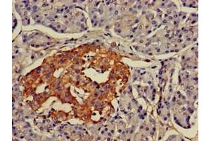 Immunohistochemistry of paraffin-embedded human pancreatic tissue using ABIN7158379 at dilution of 1:100 (LMX1A anticorps  (AA 9-86))