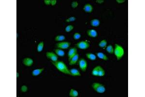 Immunofluorescent analysis of A549 cells using ABIN7160482 at dilution of 1:100 and Alexa Fluor 488-congugated AffiniPure Goat Anti-Rabbit IgG(H+L) (MYADM anticorps  (AA 1-40))