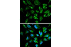 Immunofluorescence analysis of HepG2 cell using KIR2DL3 antibody.