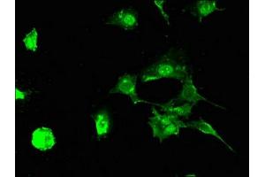 anti-STIP1 Homology and U-Box Containing Protein 1 (STUB1) (AA 1-48) antibody