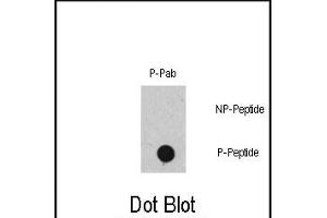 Dot blot analysis of Phospho-RAF1- polyclonal antibody (ABIN389732 and ABIN2839672) on nitrocellulose membrane. (RAF1 anticorps  (pSer471))