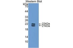 WB of Protein Standard: different control antibodies against Highly purified E. (Haptoglobin Kit ELISA)