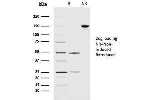 SDS-PAGE Analysis Purified PD-L2 Mouse Monoclonal Antibody (PDL2/2676). (PDCD1LG2 anticorps  (AA 27-220))