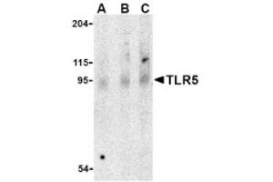 Image no. 1 for anti-Toll-Like Receptor 5 (TLR5) (Middle Region) antibody (ABIN265143) (TLR5 anticorps  (Middle Region))