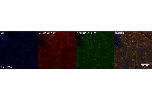 Immunohistochemistry (IHC) image for anti-Nuclear Receptor Subfamily 3, Group C, Member 2 (NR3C2) antibody (ABIN7456215)