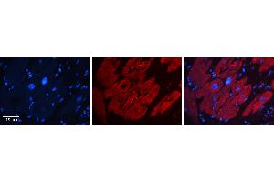 Rabbit Anti-G3BP1 Antibody   Formalin Fixed Paraffin Embedded Tissue: Human heart Tissue Observed Staining: Cytoplasmic, plasma membrane Primary Antibody Concentration: 1:100 Other Working Concentrations: 1:600 Secondary Antibody: Donkey anti-Rabbit-Cy3 Secondary Antibody Concentration: 1:200 Magnification: 20X Exposure Time: 0.