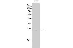 Western Blotting (WB) image for anti-Calcium Binding Protein 7 (CABP7) (N-Term) antibody (ABIN3174122) (CABP7 anticorps  (N-Term))