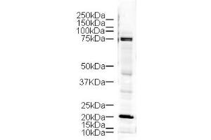Image no. 1 for anti-LIM Domain Kinase 1 (LIMK1) (AA 630-647) antibody (ABIN401293) (LIM Domain Kinase 1 anticorps  (AA 630-647))