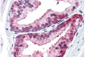 Human Prostate: Formalin-Fixed, Paraffin-Embedded (FFPE)