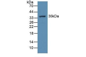 Figure. (ATP6AP2 anticorps  (AA 18-302))