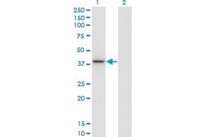 Western Blot analysis of PARVG expression in transfected 293T cell line by PARVG monoclonal antibody (M01), clone 4E1.