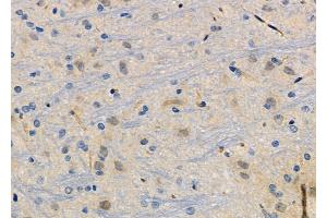 ABIN6266129 and ABIN6272494 at 1/100 staining Rat brain tissue by IHC-P. (ZNF462 anticorps  (Internal Region))