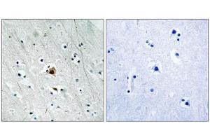 Immunohistochemistry analysis of paraffin-embedded human brain tissue using MAPKAPK2 (Phospho-Ser272) antibody. (MAPKAP Kinase 2 anticorps  (pSer272))