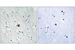Immunohistochemistry analysis of paraffin-embedded human brain tissue using MAPKAPK2 (Phospho-Ser272) antibody.