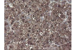 Image no. 4 for anti-Aminoacylase 1 (ACY1) antibody (ABIN1496455) (Aminoacylase 1 anticorps)