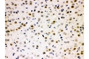 IHC testing of FFPE rat brain with CDC25B antibody. (CDC25B anticorps  (AA 119-248))