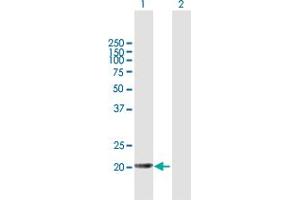 Western Blot analysis of APRT expression in transfected 293T cell line by APRT MaxPab polyclonal antibody. (APRT anticorps  (AA 1-180))