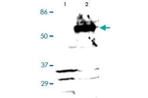 Western Blot (Cell lysate) analysis of (1) Negative control (vector only transfected HEK293 cells), and (2) HEK293 cells transfected with RARA construct. (Retinoic Acid Receptor alpha anticorps  (C-Term))