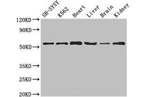 Western Blot Positive WB detected in: SH-SY5Y whole cell lysate, K562 whole cell lysate, Mouse heart tissue, Mouse liver tissue, Mouse brain tissue, Mouse kidney tissue All lanes: SLC16A9 antibody at 3. (SLC16A9 anticorps  (AA 185-304))