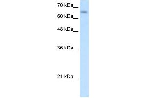 WB Suggested Anti-SLC39A12 Antibody Titration:  0.