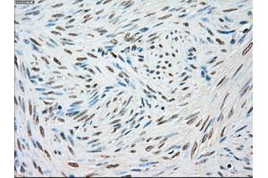 Immunohistochemical staining of paraffin-embedded Kidney tissue using anti-STK3mouse monoclonal antibody. (STK3 anticorps)