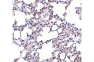 Immunohistochemistry of TRPC6 in mouse lung tissue with this product at 10 μg/ml. (TRPC6 anticorps  (N-Term))