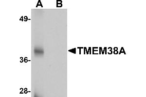 Western blot analysis of TMEM38A in rat skeletal muscle tissue lysate with TMEM38A antibody at 1 µg/mL in (A) the absence and (B) the presence of blocking peptide. (TMEM38A anticorps  (C-Term))
