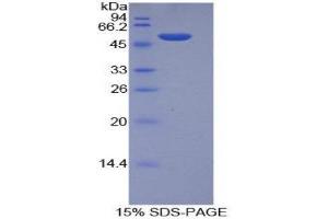 SDS-PAGE (SDS) image for Integrin, alpha 6 (ITGA6) (AA 903-1073) protein (His tag,GST tag) (ABIN1877684)