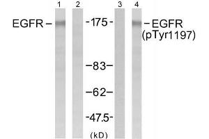 Western blot analysis of extract from A431 cells untreated or treated with EGF (200ng/ml, 5min), using EGFR (Ab-1197) antibody (E021221, Lane1 and 2) and EGFR (phospho-Tyr1197) antibody (E011228, Lane 3 and 4). (EGFR anticorps)