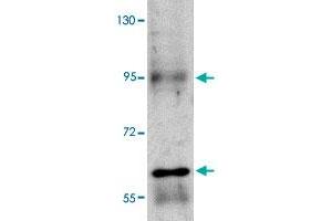 Western blot analysis of RUSC1 in A-20 cell lysate with RUSC1 polyclonal antibody  at 1 ug/mL . (RUSC1 anticorps  (C-Term))