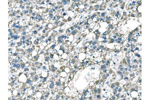 IHC analysis of B Raf/BRAF using anti-B Raf/BRAF antibody (ABIN3043761). (BRAF anticorps  (AA 38-230))