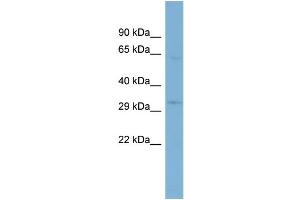 WB Suggested Anti-TMEM110  Antibody Titration: 0. (TMEM110 anticorps  (N-Term))