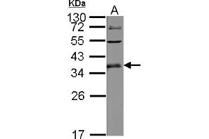Western Blotting (WB) image for anti-UL16 Binding Protein 1 (ULBP1) (AA 1-234) antibody (ABIN1501673) (ULBP1 anticorps  (AA 1-234))
