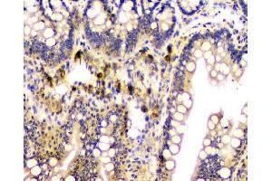 IHC analysis of CA2 using anti-CA2 antibody (ABIN6719533). (CA2 anticorps  (AA 2-260))