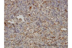 Immunoperoxidase of monoclonal antibody to SNAP23 on formalin-fixed paraffin-embedded human spleen.