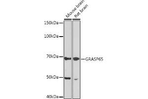 Western blot analysis of extracts of various cell lines, using GR Rabbit mAb (ABIN1679751, ABIN3015980, ABIN3015981 and ABIN7101472) at 1:1000 dilution. (GORASP1 anticorps)