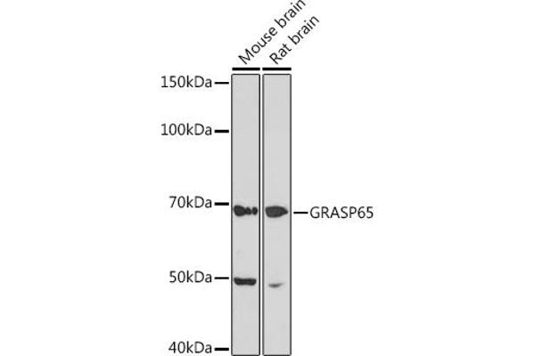 GORASP1 anticorps