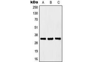 Western blot analysis of HOXB4 expression in Jurkat (A), K562 (B), PC12 (C) whole cell lysates. (HOXB4 anticorps  (Center))