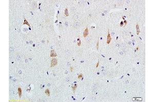 Formalin-fixed and paraffin embedded rat brain tissue labeled with Rabbit Anti-NGF-beta Polyclonal Antibody  at 1:200 followed by conjugation to the secondary antibody and DAB staining. (NGFB anticorps  (AA 151-220))