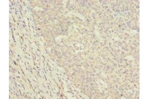 Immunohistochemistry of paraffin-embedded human tonsil tissue using ABIN7150497 at dilution of 1:100