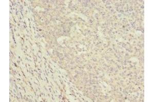 Immunohistochemistry of paraffin-embedded human tonsil tissue using ABIN7150497 at dilution of 1:100 (DNAJA2 anticorps  (AA 233-412))