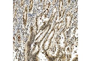 IHC analysis of RCC1 using anti-RCC1 antibody (ABIN7600024). (RCC1 anticorps  (AA 14-421))