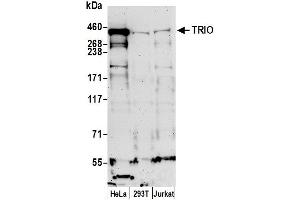 anti-Triple Functional Domain Protein (TRIO) (AA 1575-1625) antibody