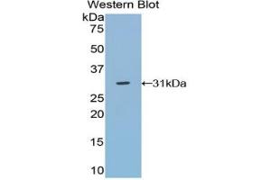 Western blot analysis of the recombinant protein. (TRADD anticorps  (AA 21-259))