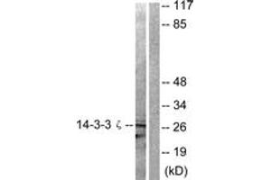 Western blot analysis of extracts from 293 cells, treated with Forskolin 40nM 30', using 14-3-3 zeta (Ab-58) Antibody. (14-3-3 zeta anticorps  (AA 24-73))