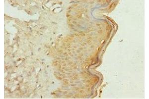 Immunohistochemistry of paraffin-embedded human skin tissue using ABIN7163882 at dilution of 1:100 (GALNT3 anticorps  (AA 1-140))