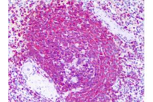 Anti-RICTOR antibody IHC of human spleen.