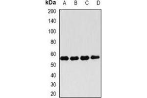 Western blot analysis of FKBP4 expression in Hela (A), Jurkat (B), MCF7 (C), mouse testis (D) whole cell lysates. (FKBP4 anticorps)