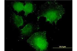 Immunofluorescence of monoclonal antibody to CNOT7 on HeLa cell.